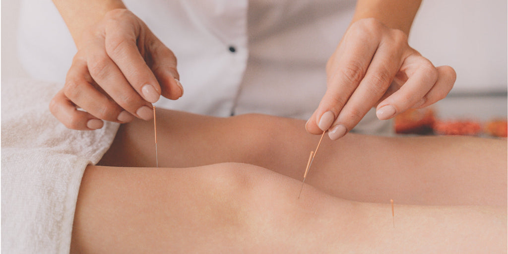 The Benefit of Acupuncture for Teens