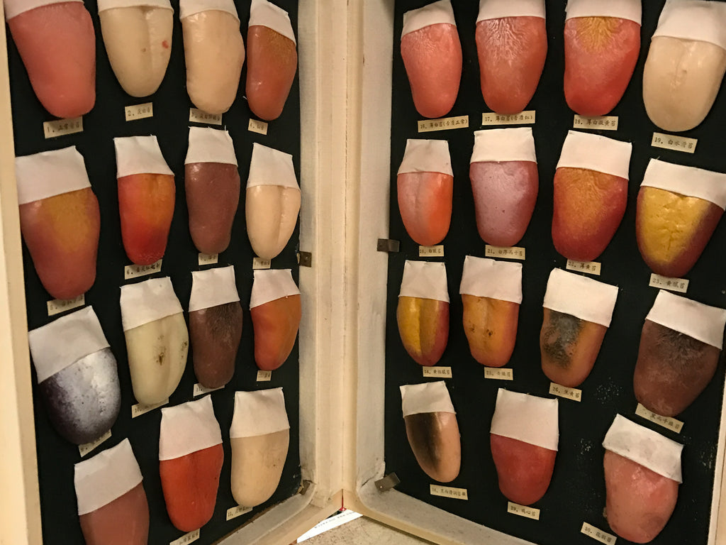 Your Tongue: Why It's So Important in Chinese Medicine