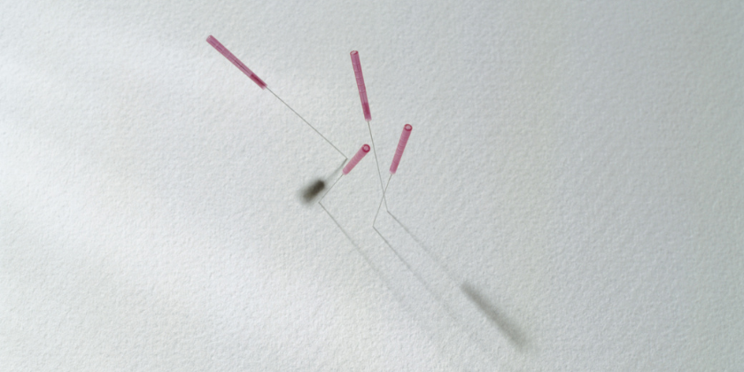 Acupuncture for Pregnancy