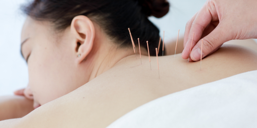 Acupuncture to Support Reproductive Wellness