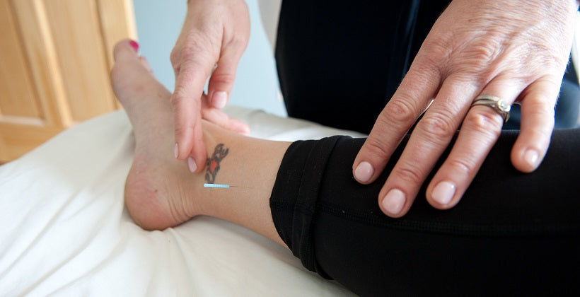 Acupuncture and Self-Care for Plantar Fasciitis