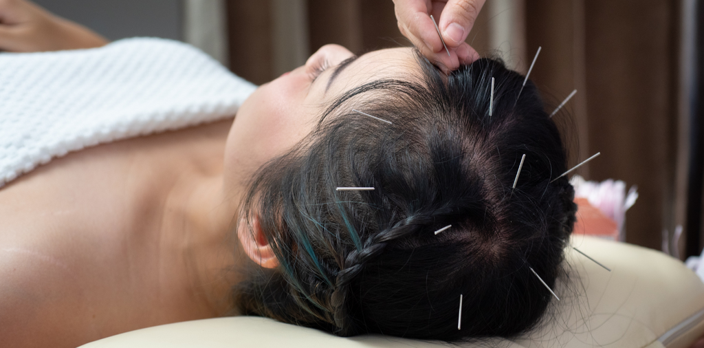 Your Brain on Acupuncture? It’s Better.