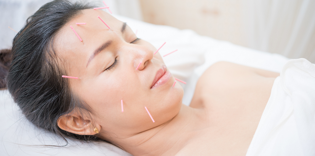 3 Ways Facial Rejuvenation Acupuncture Works