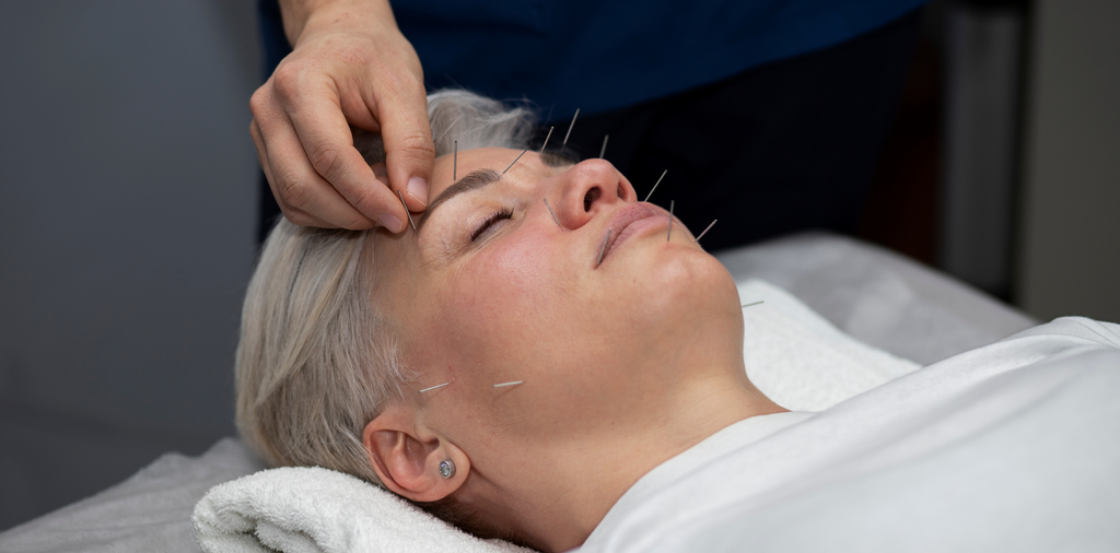 Is Facial Acupuncture Really Effective? And Is It Better Than Botox?