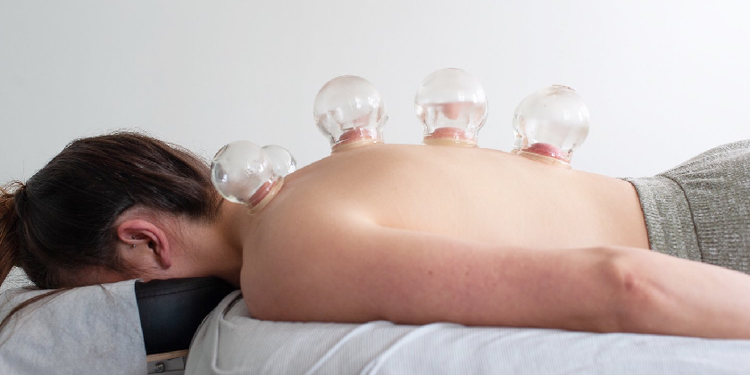 Traditional Chinese Medicine Cupping: What is It?