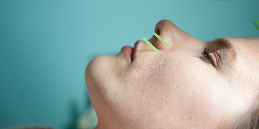 Acupuncture's Effect on Endorphins (& Why It Feels So Good!)