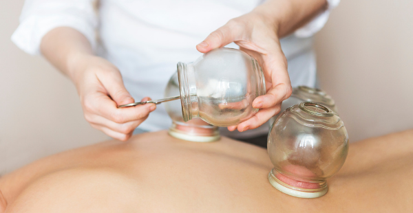 The Benefits of Cupping, According to Research