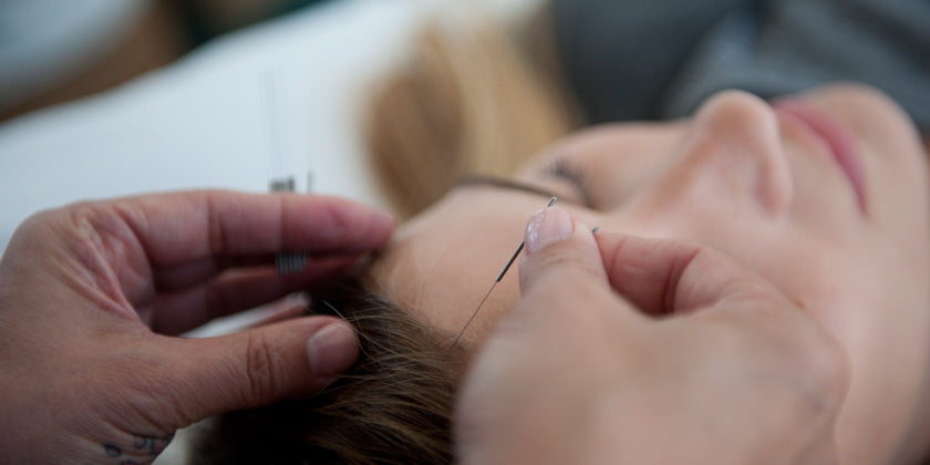 The Sensation of Your First Acupuncture Needles