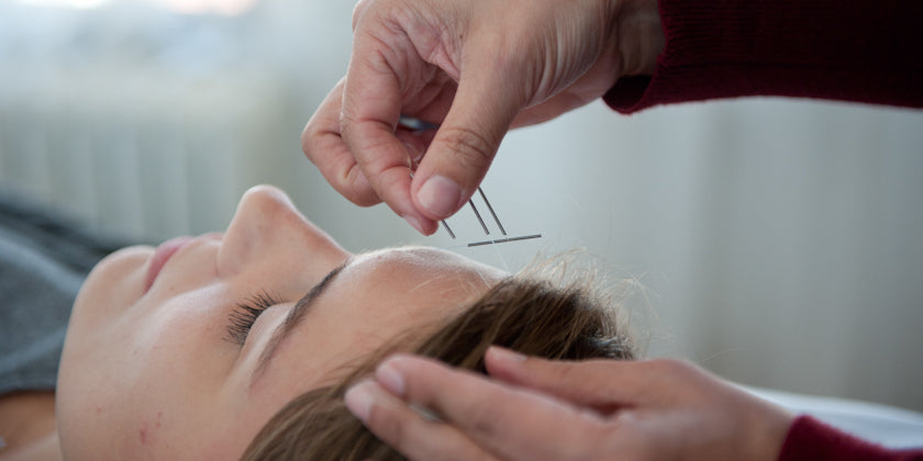 New Year's Resolutions: How Acupuncture Can Help