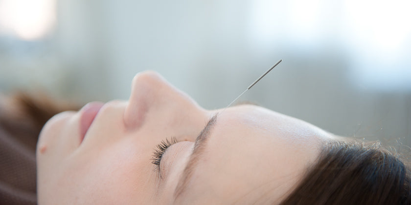 Thinking About Giving Acupuncture a Try?  You're Not Alone.
